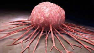 Identifican el punto débil del cáncer