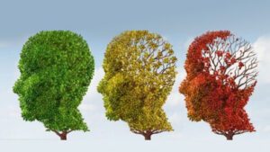 Un fármaco consigue evitar los síntomas de alzheimer